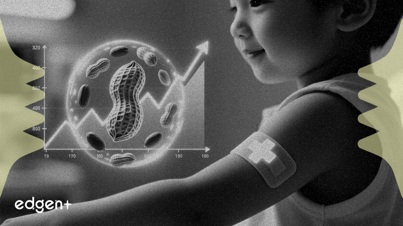 Miếng dán trị dị ứng đậu phộng DBV cho thấy hiệu quả 83% trong thử nghiệm Giai đoạn 3