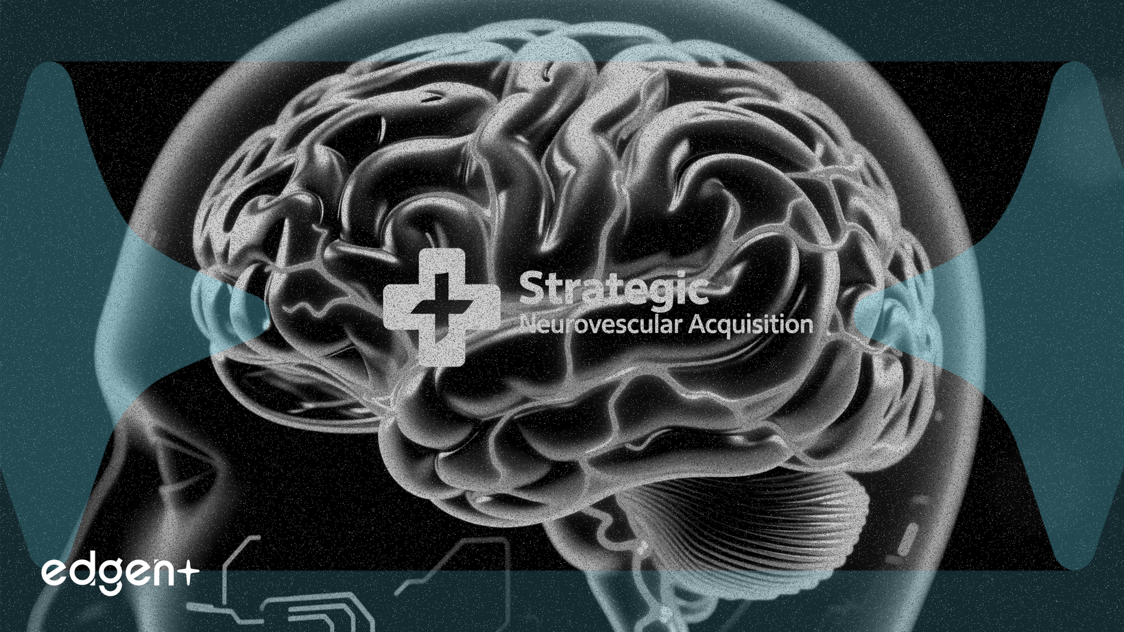 波士頓科學將收購Penumbra，進軍神經血管市場