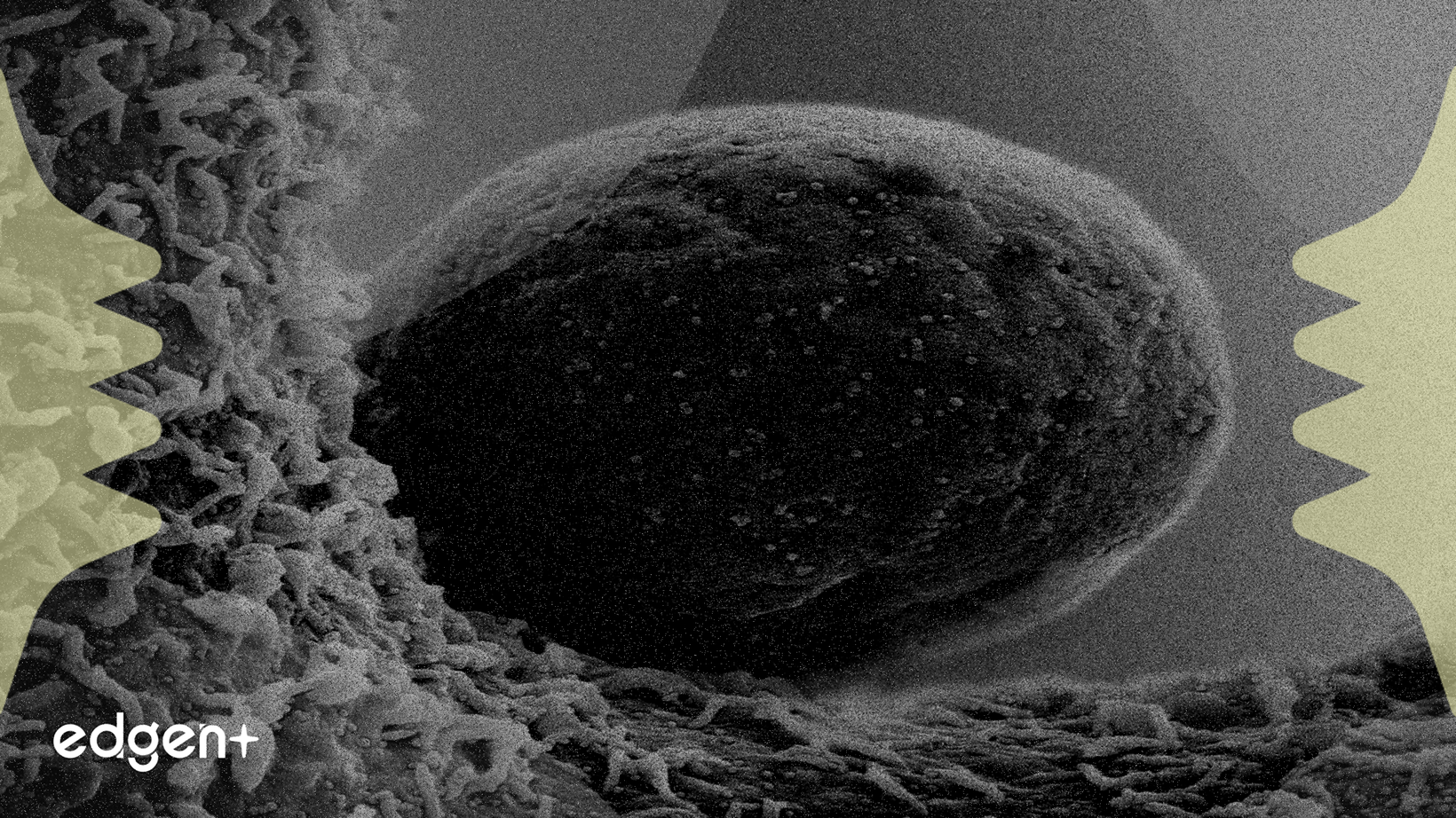 J&J Backs Link Cell's $60M Cancer Therapy Launch