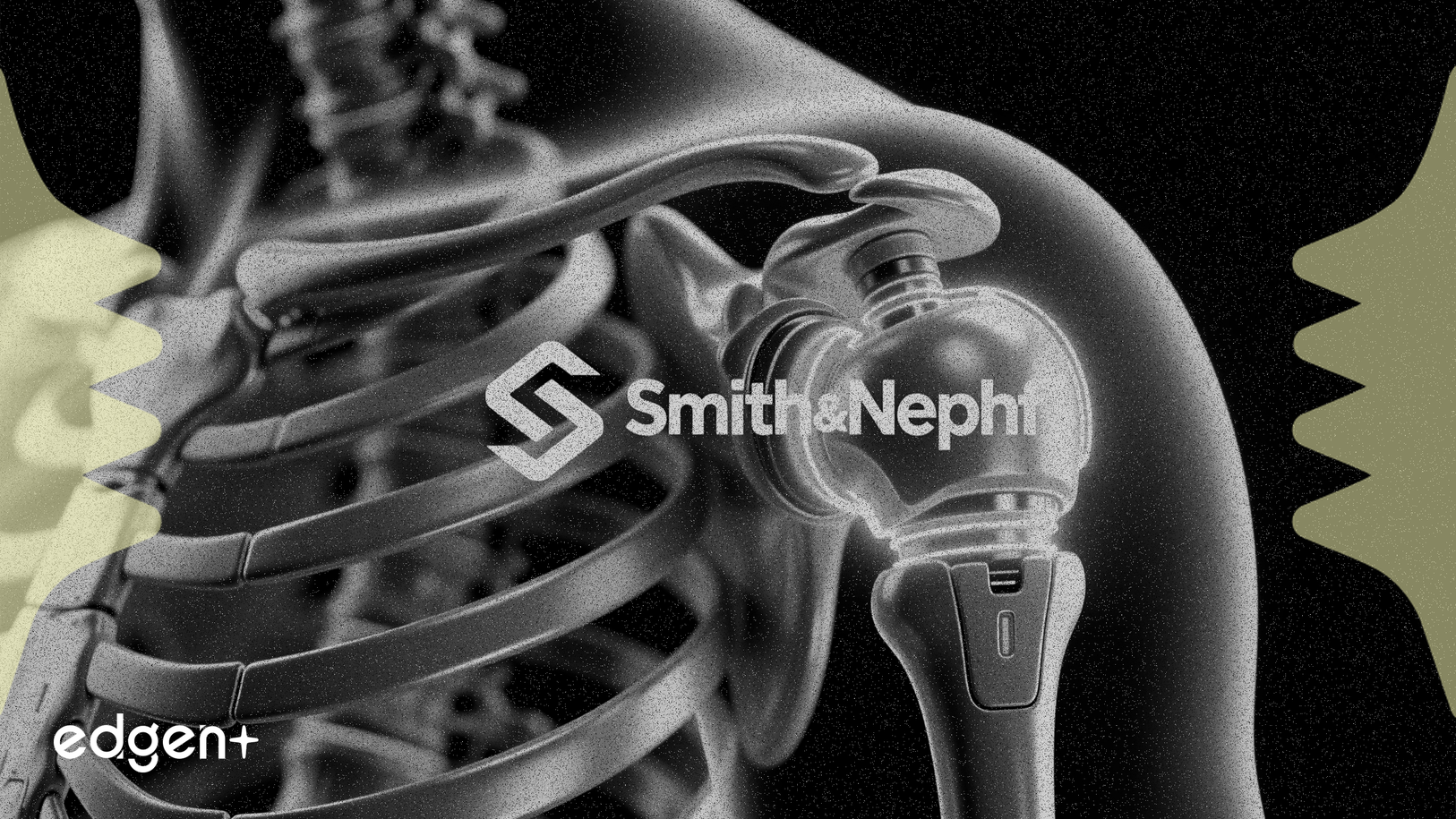 스미스앤드네퓨, 어깨 수리 기술 강화를 위해 Integrity Orthopaedics 인수
