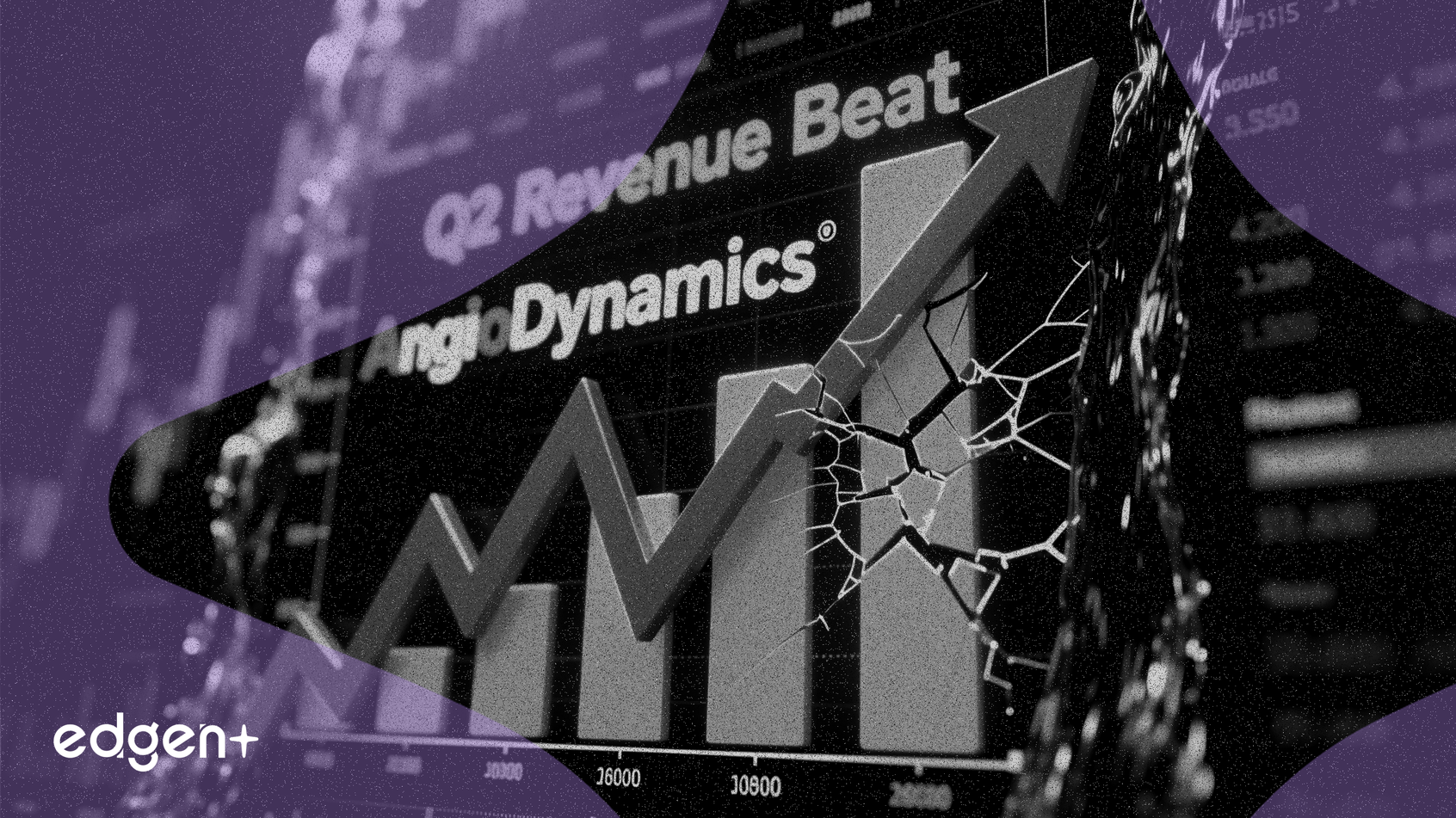 儘管第二季度營收超預期，AngioDynamics股價仍暴跌13.5%