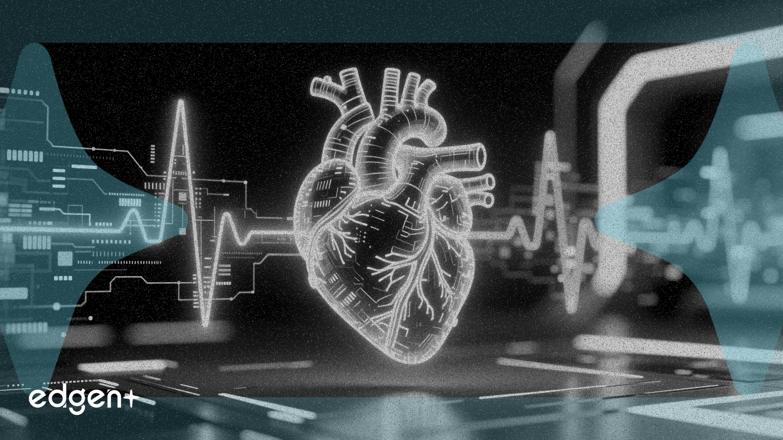 펄스 바이오사이언스, 주요 심포지엄에서 12개월 심방세동 연구 데이터 공개 예정