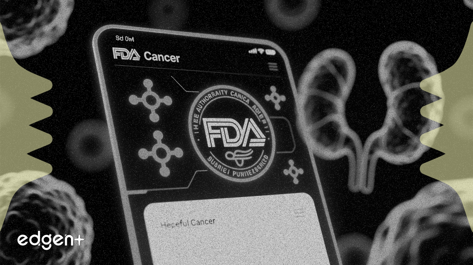 ImmunityBio soumet à nouveau sa demande ANKTIVA à la FDA pour un usage élargi dans le cancer de la vessie