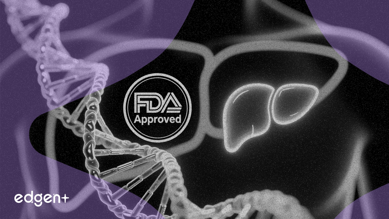 GENFIT, 간 질환 치료제 NTZ FDA 희귀의약품 지정 확보