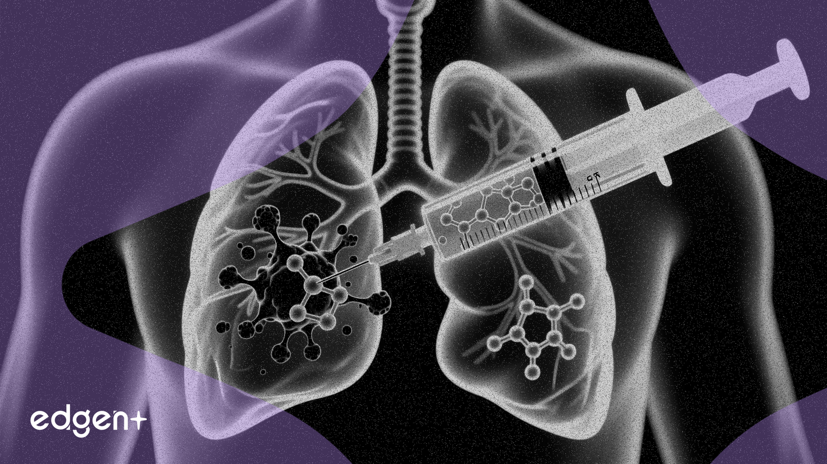 Nuvectis Initiates Phase 1b Lung Cancer Drug Trial