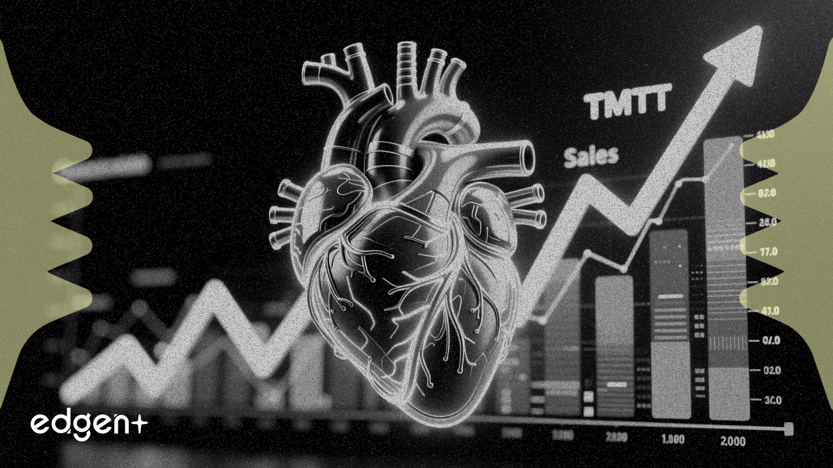 愛德華生命科學第四季度銷售額增長13.3%，得益於TMTT業務增長