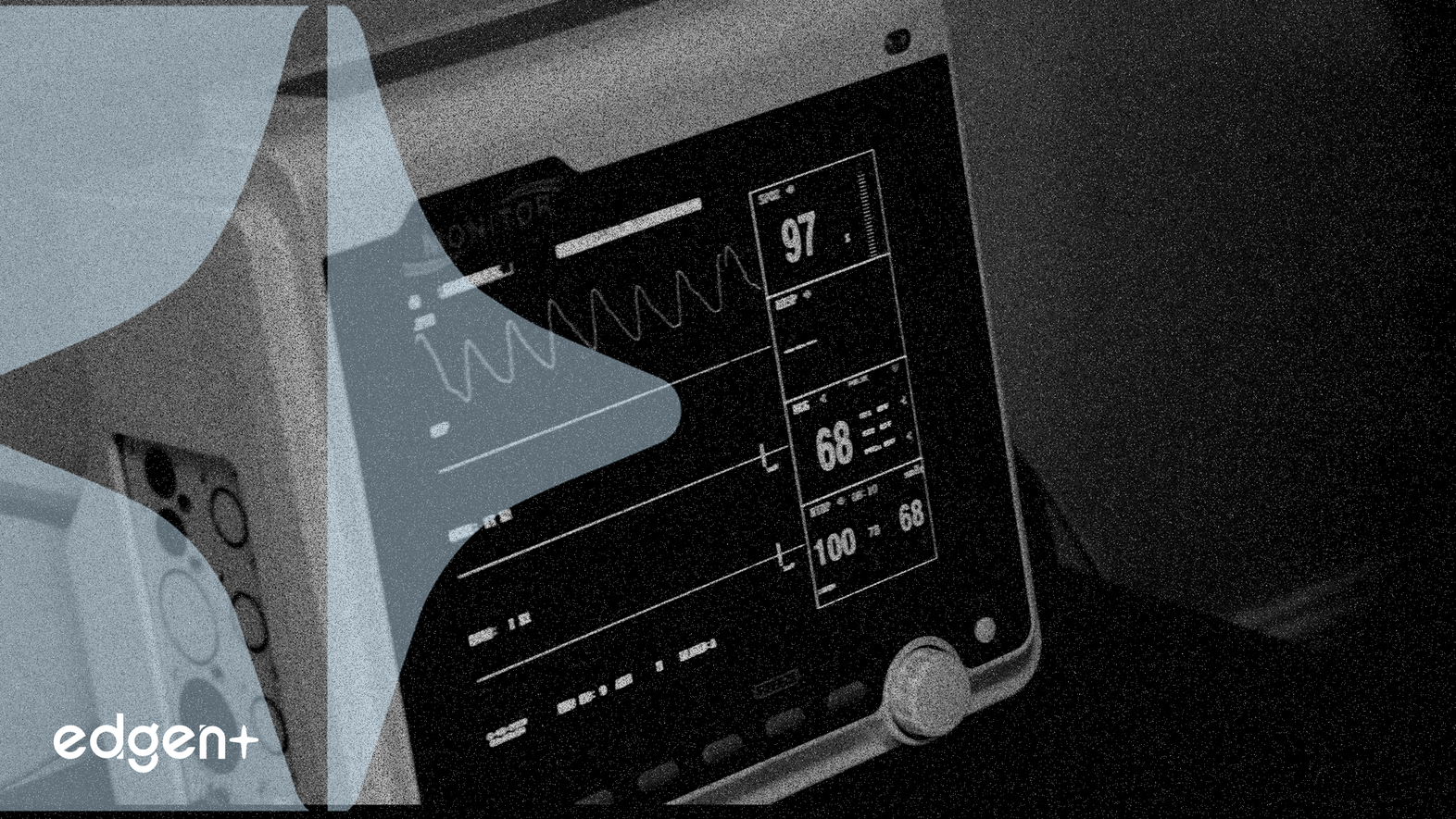Nanox.AI, NHS Kemik Çözümleri Erken Değerlendirmesi için NICE Tavsiyesi Aldı