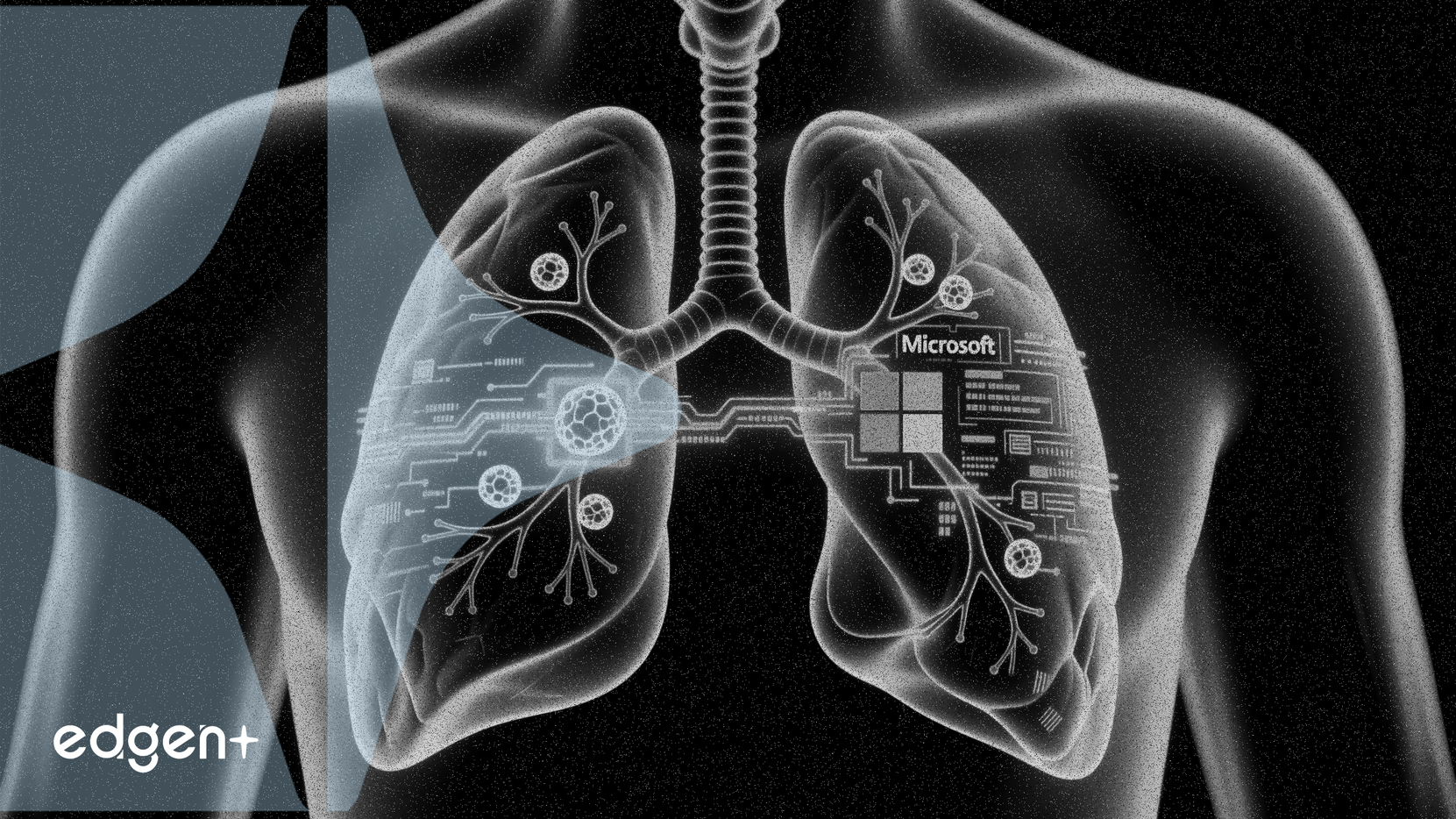 브리스톨 마이어스 스큅, 마이크로소프트 AI와 폐암 진단 협력