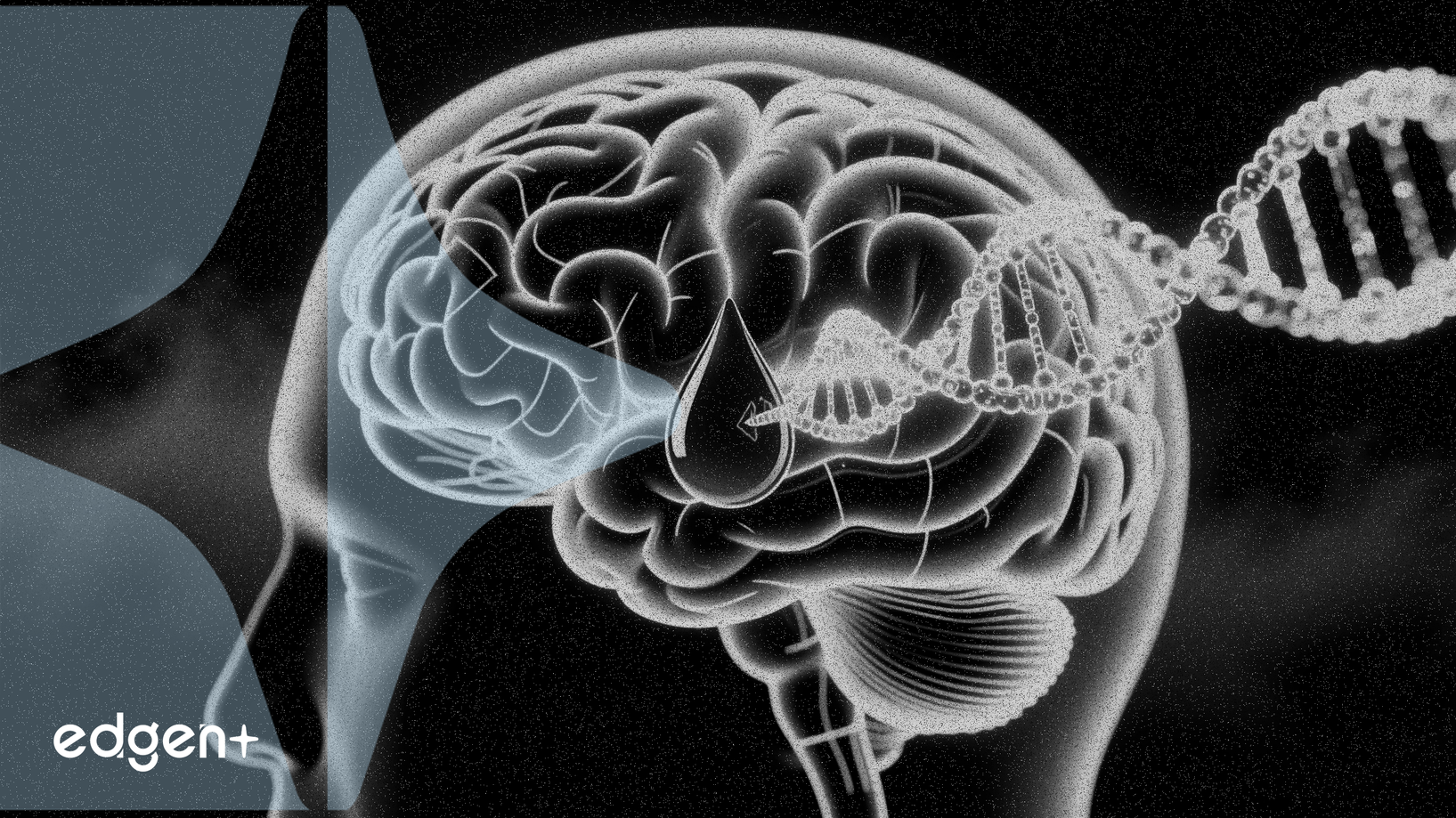 Labcorp 瞄準阿茲海默症市場 推出首個FDA批准的血液檢測