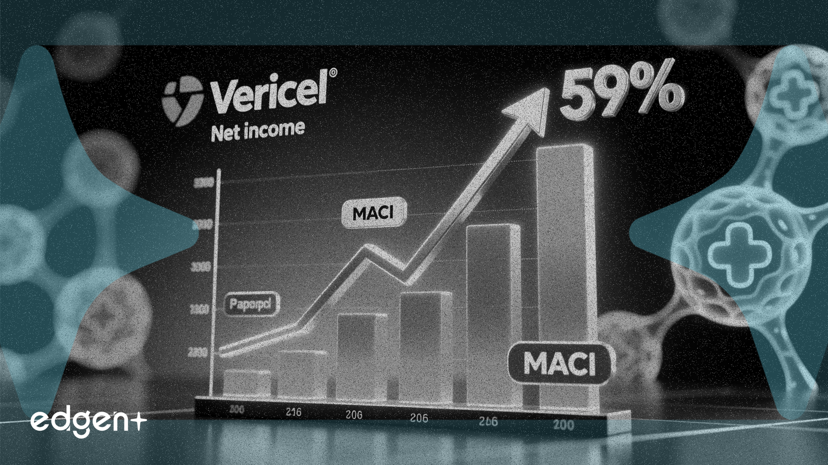 Le bénéfice net de Vericel bondit de 59 % grâce aux solides ventes de MACI