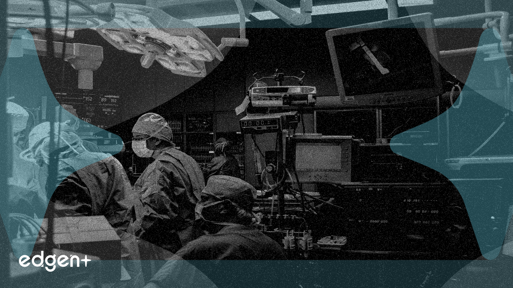 Intuitive Surgical, GLP-1 약물 역풍 헤쳐나가다