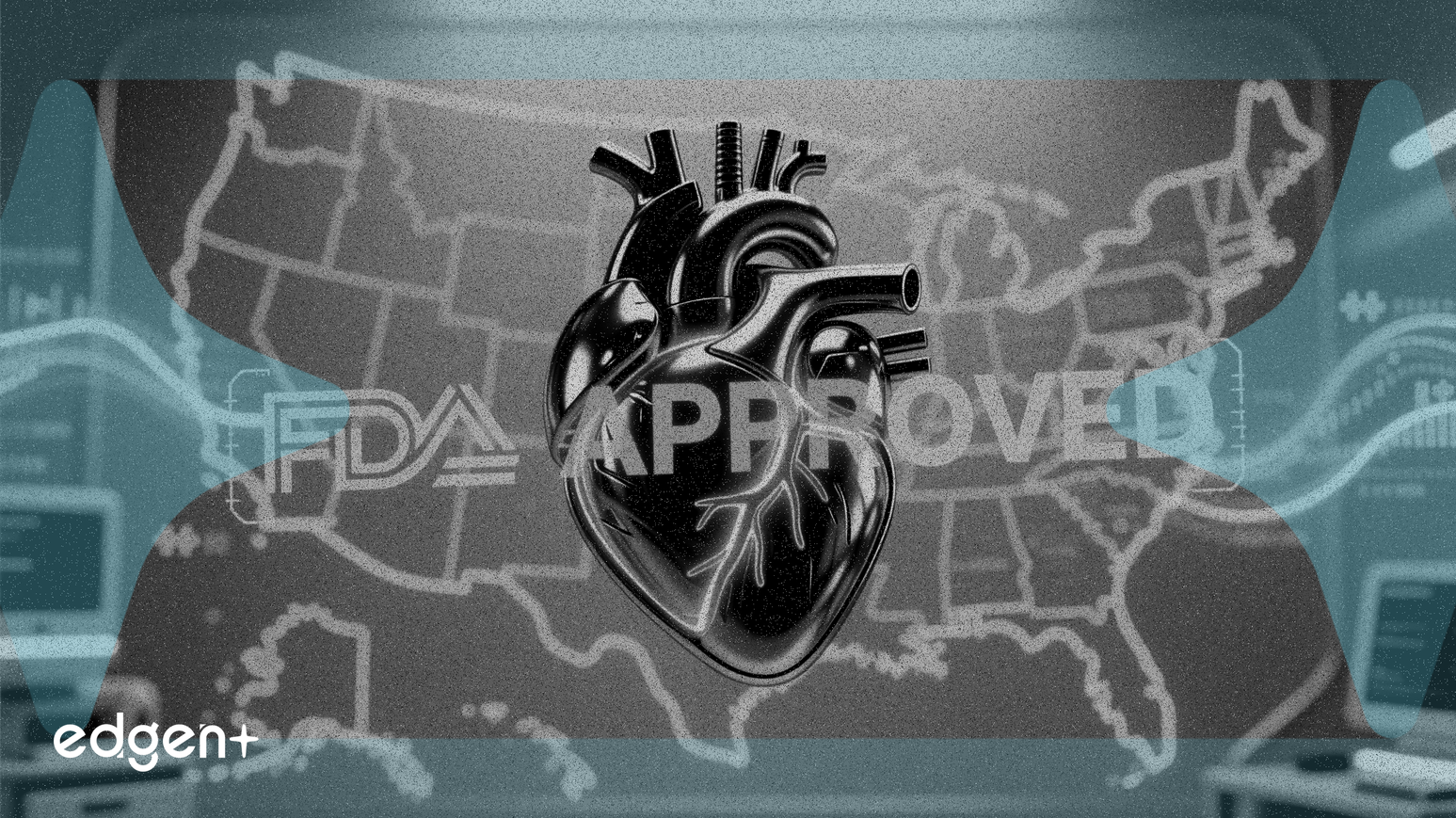 Jianshi Tech obtient l'approbation de la FDA pour un essai clinique de valve cardiaque aux États-Unis