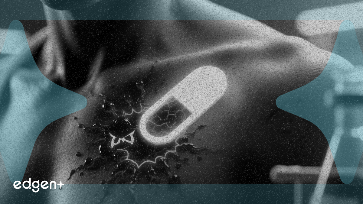 Celldex Drug Hits 71% Response Rate in Hives Trial