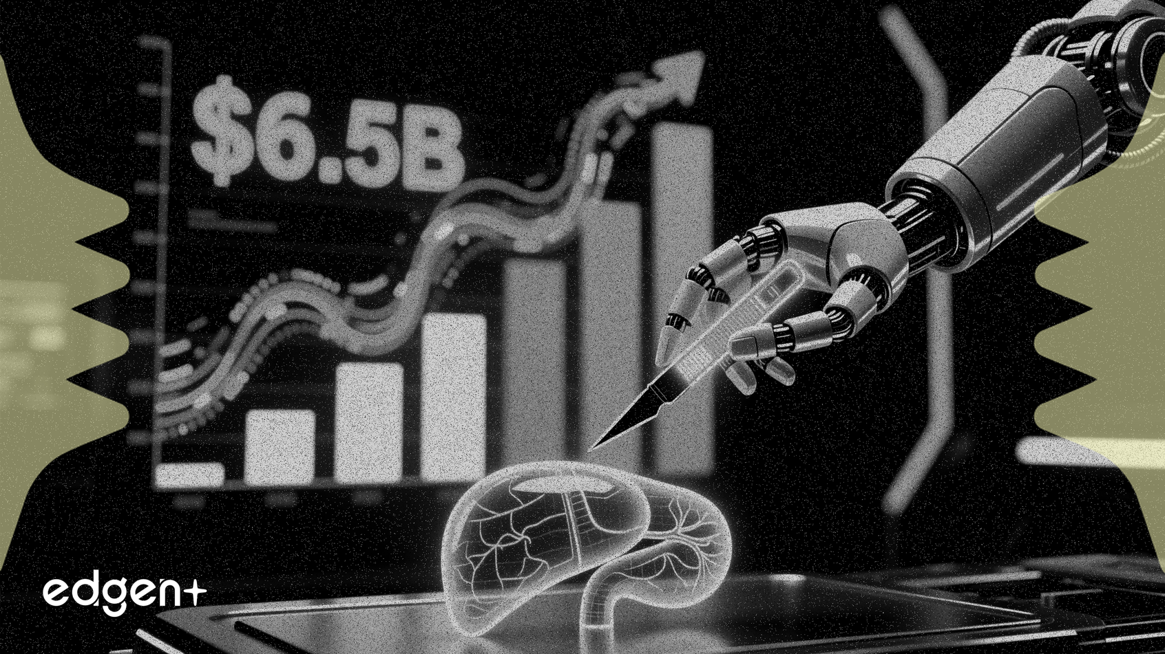 Le marché de la chirurgie numérique atteindra 6,5 milliards de dollars, porté par une croissance annuelle de 27,4%