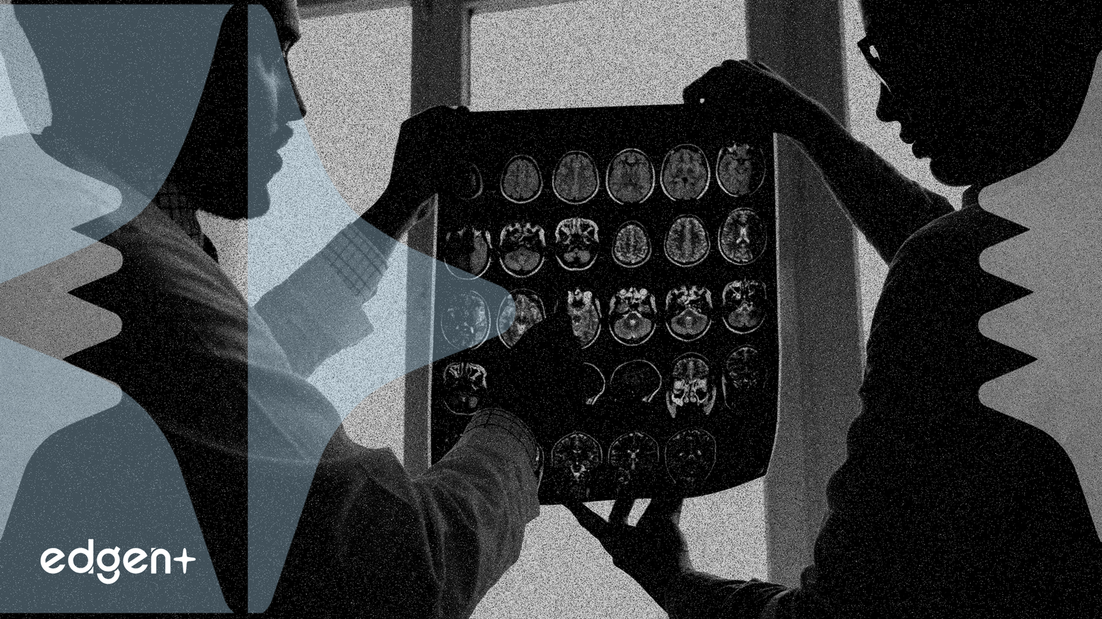 Acadia CEO to Outline 2026 Pipeline at January J.P. Morgan Conference