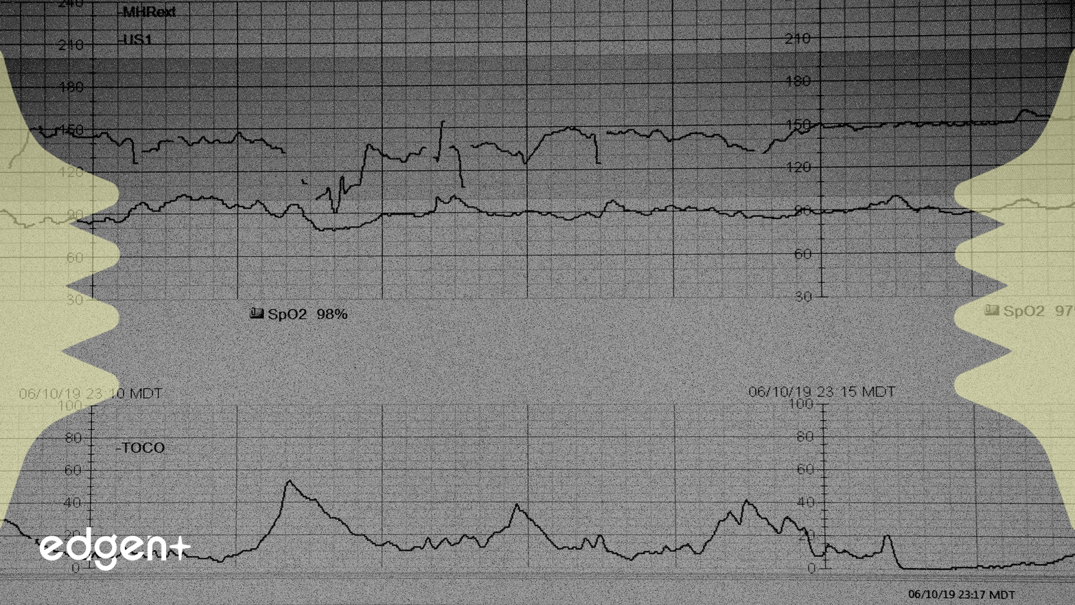 Healthcare Sector Demonstrates Strength Amid Technical Momentum and Strategic M&A