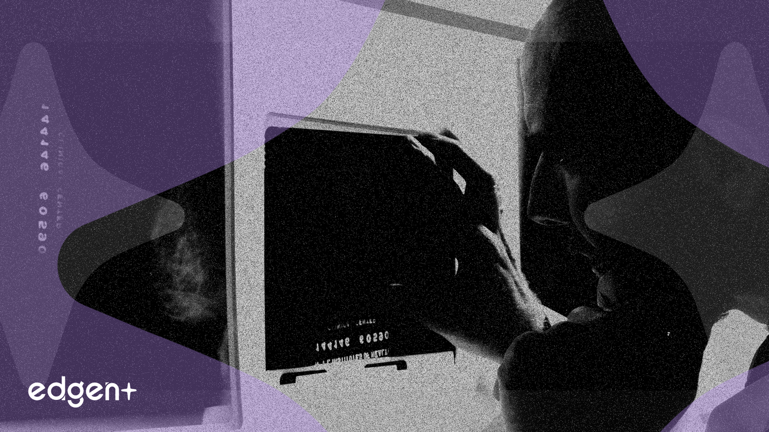 Hologic gagne 15,9% avant une acquisition par capital-investissement de 18,3 milliards de dollars