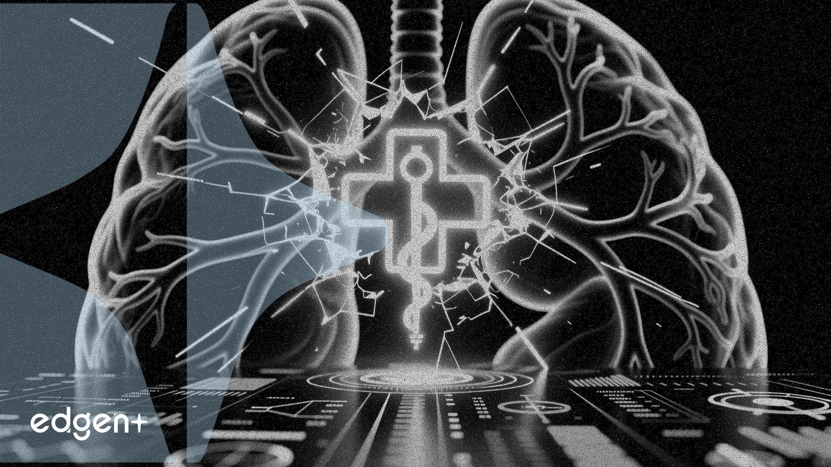 United Therapeutics' Tyvaso Succeeds in Phase 3 IPF Trial