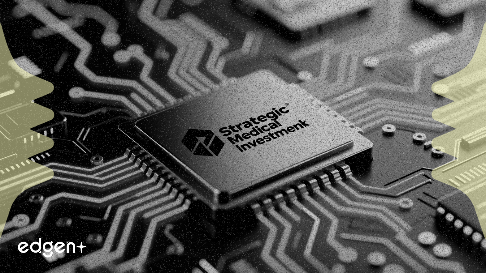 블랙록 계열사, Sequana Medical 지분 4.19% 인수