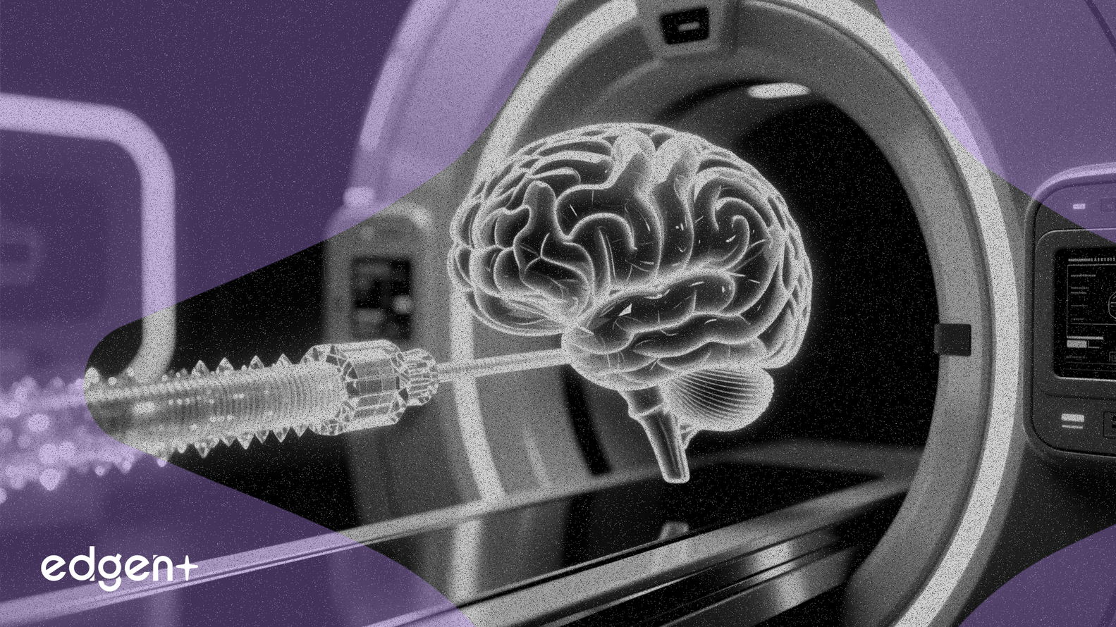 Coherent, 새로운 AxioView 광섬유로 의료 영상 시장 공략