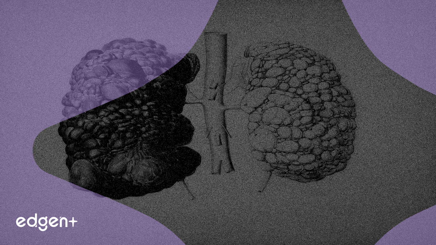 中國生物製藥啟動全球首個IPF藥物TDI01 III期臨床試驗