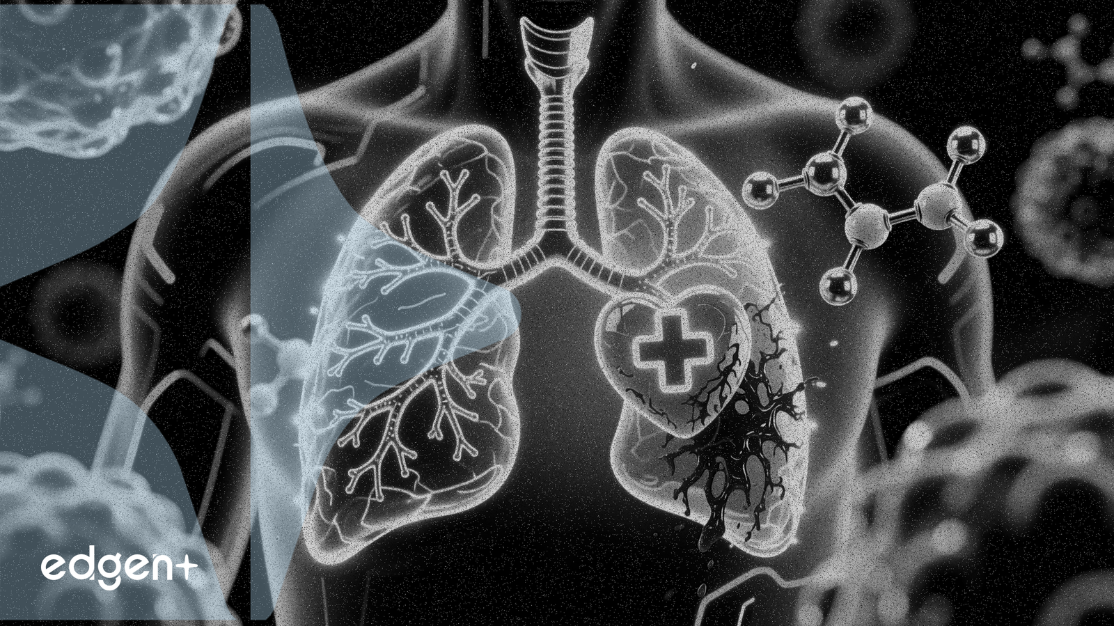 Hansoh Pharma obtient l'approbation pour un médicament de première ligne contre le cancer du poumon