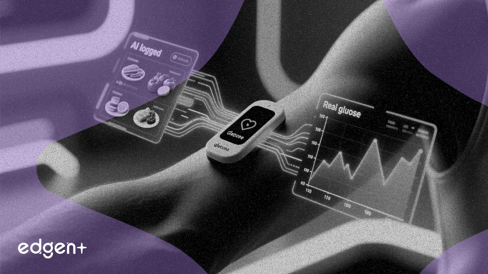 デックスコム、Stelo血糖センサー向けにAI食事記録機能を展開