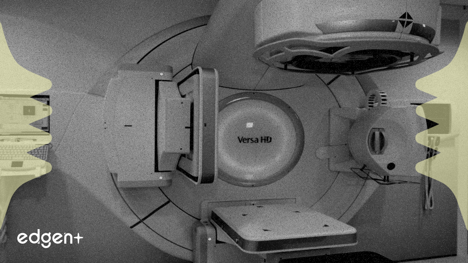 Accuray, Radyoterapi Yeteneklerini Geliştirmek İçin Stellar Çözümünü Tanıttı