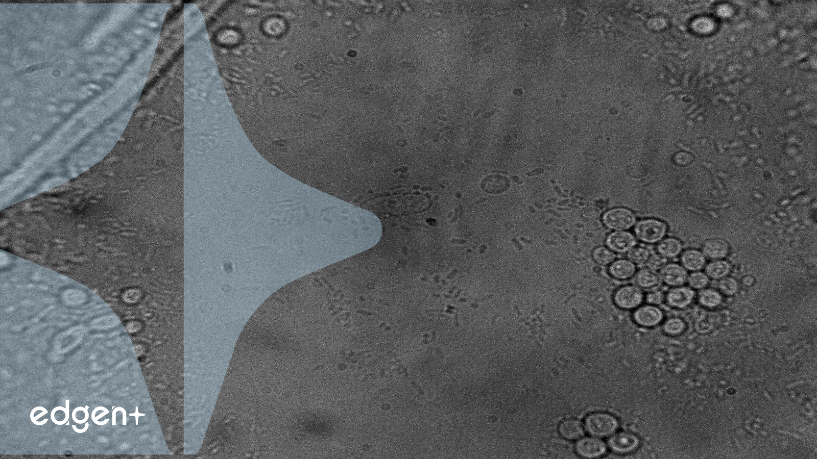 Nurix Therapeutics Thúc đẩy Ứng cử viên Thuốc hàng đầu, Khởi động Nghiên cứu CLL then chốt