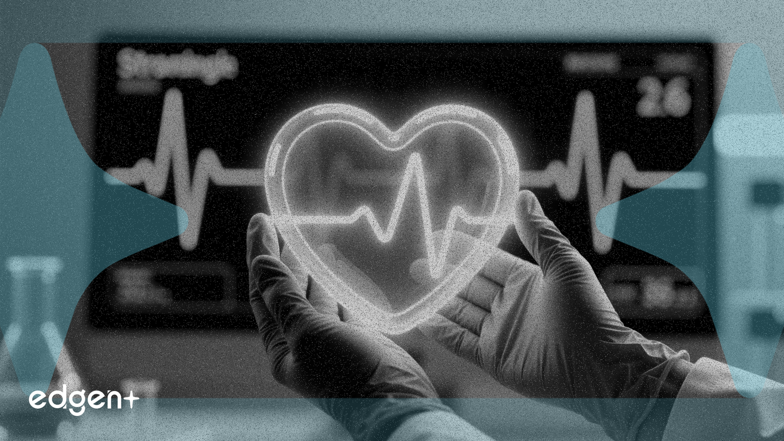 Camzyos de Bristol-Myers tiene éxito en el ensayo de afecciones cardíacas en adolescentes