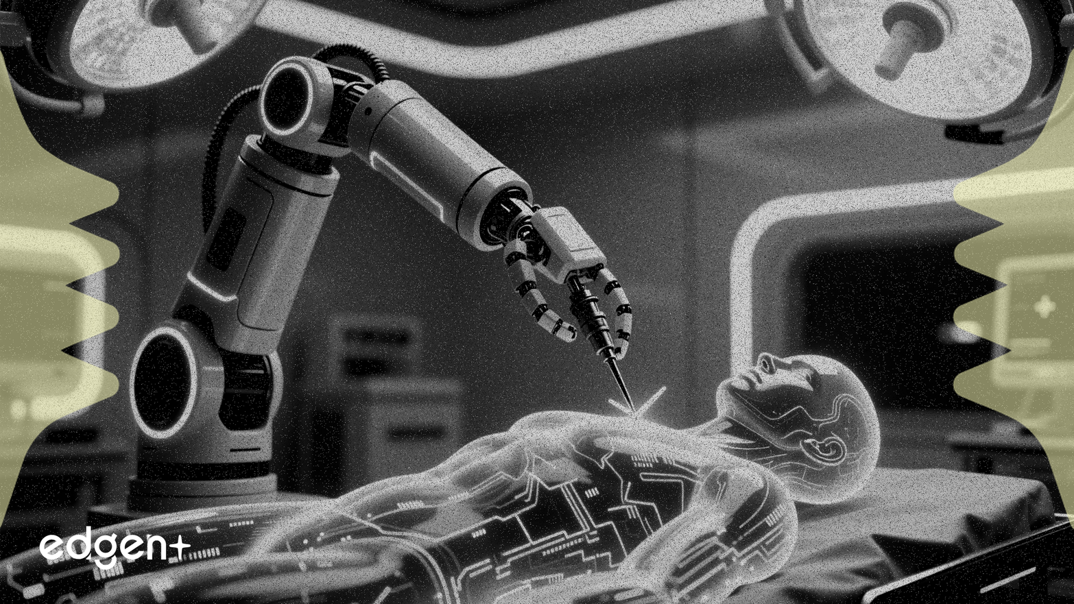 微創醫療機器人實現全球首例AI自主手術