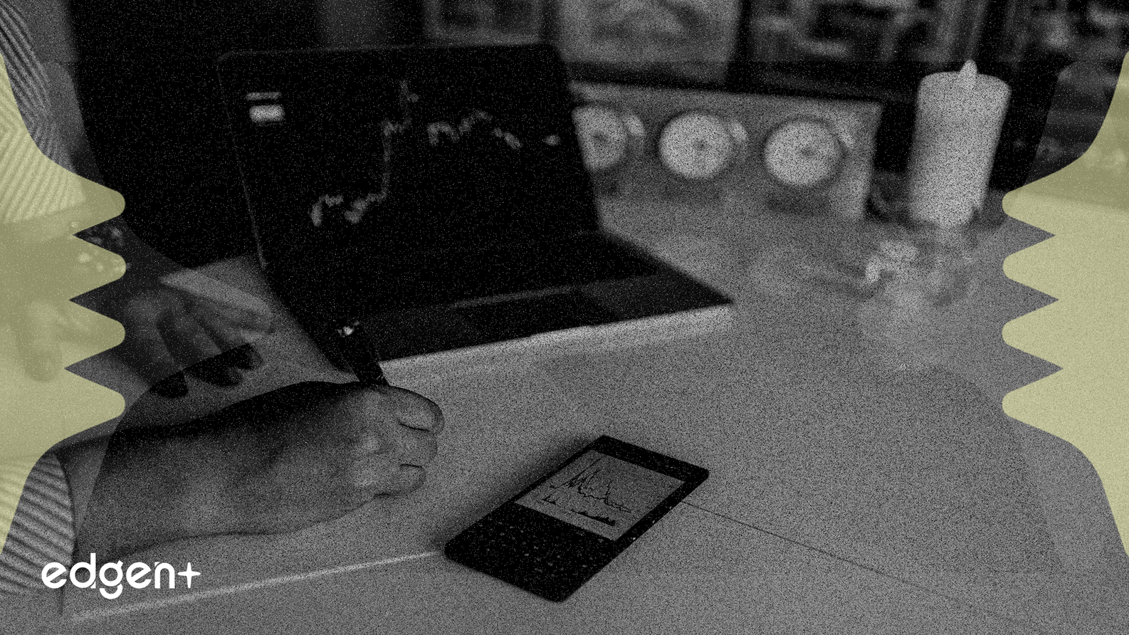 IBIT Options Surge Signals Broad Institutional Demand