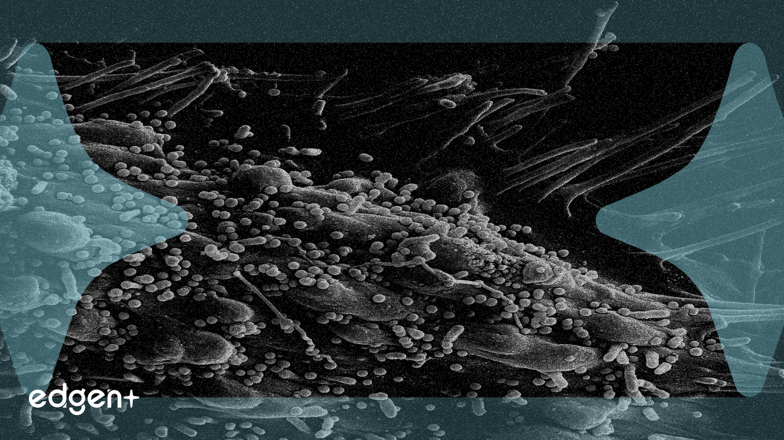 Vaxcyte Tipped for 250% Rebound on Vaccine Potential