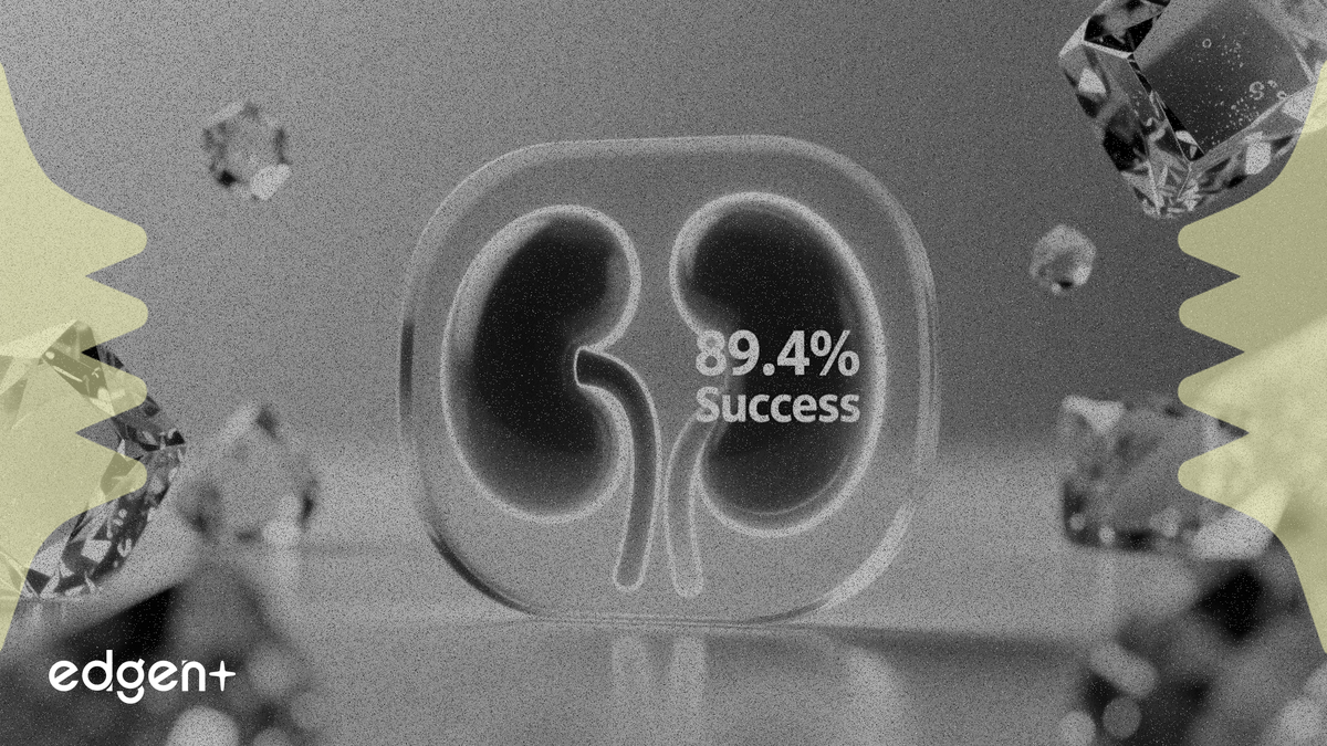 IceCure 신장암 임상, 89.4% 성공률 기록