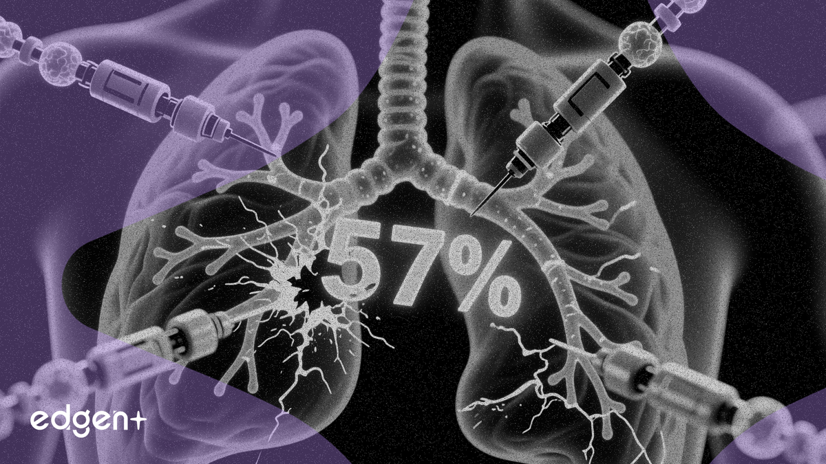 Nanobiotix, Faz 2 Akciğer Kanseri Çalışmasında %57 Tam Yanıt Oranı Bildirdi