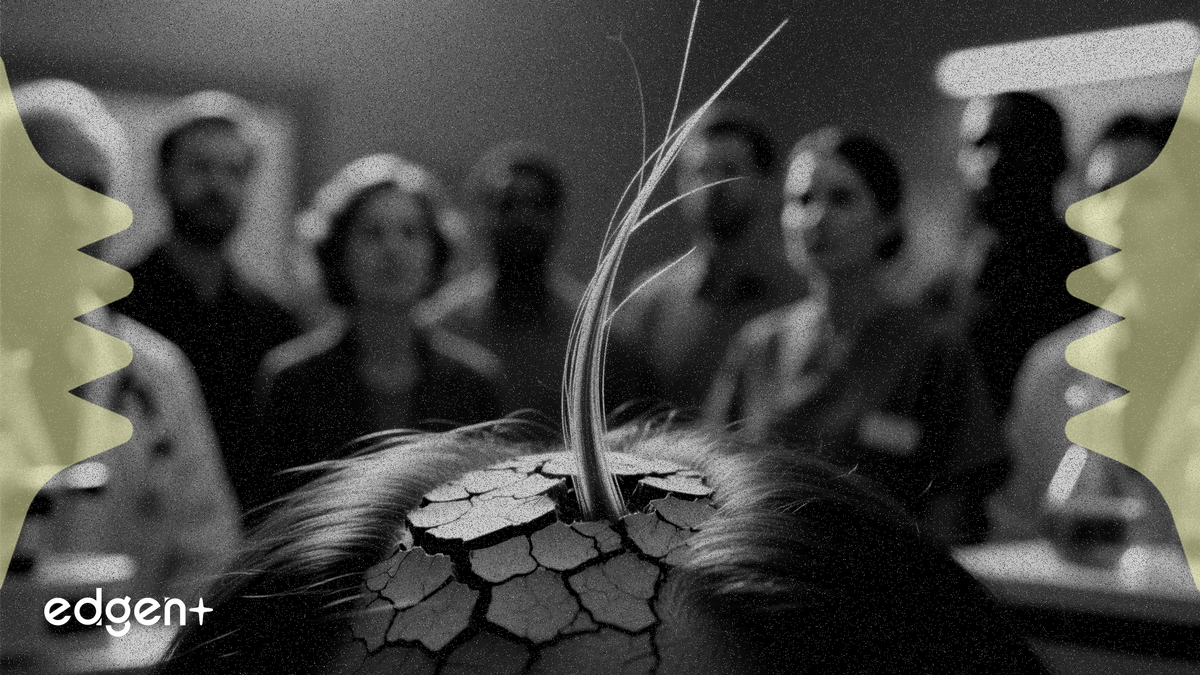 Priovant, 10만 명에게 영향을 미치는 탈모 질환에 대한 임상 3상 시험 착수