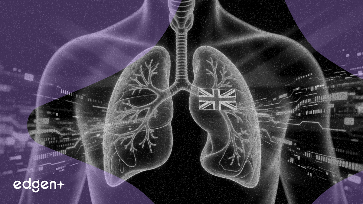 Savara được Anh phê duyệt quy trình đánh giá nhanh 150 ngày cho thuốc điều trị phổi