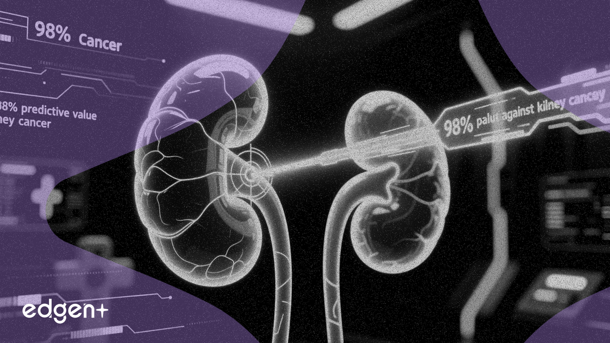 Telix Böbrek Kanseri Taraması Yeni Analizde %98 Öngörücü Değer Gösterdi