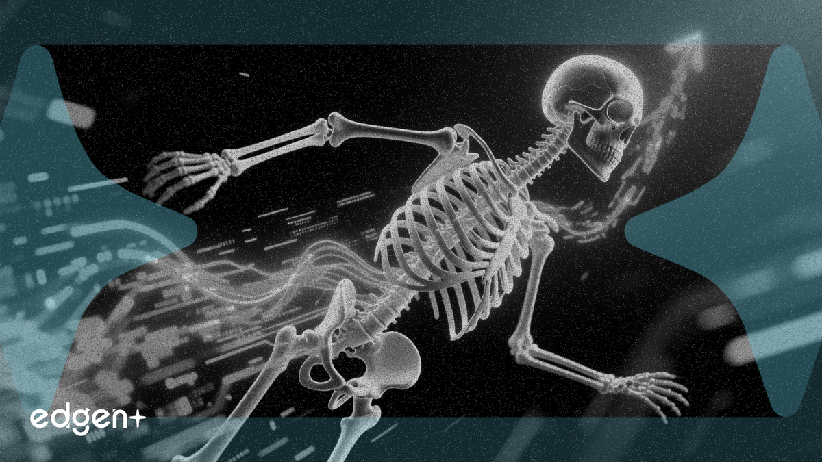 트랜스콘 병용 요법, 연골무형성증 임상 시험에서 성장 혜택 가속화