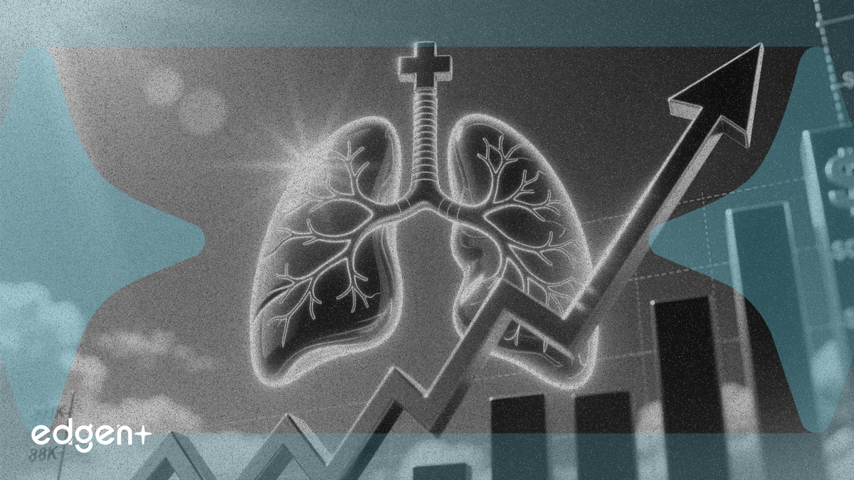 United Therapeutics Jumps 13% as Tyvaso Succeeds in Lung Trial