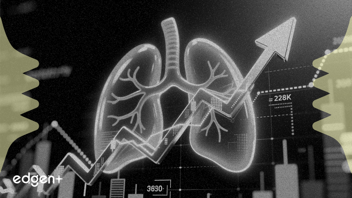 联合治疗公司肺部药物数据积极，股价上涨13%